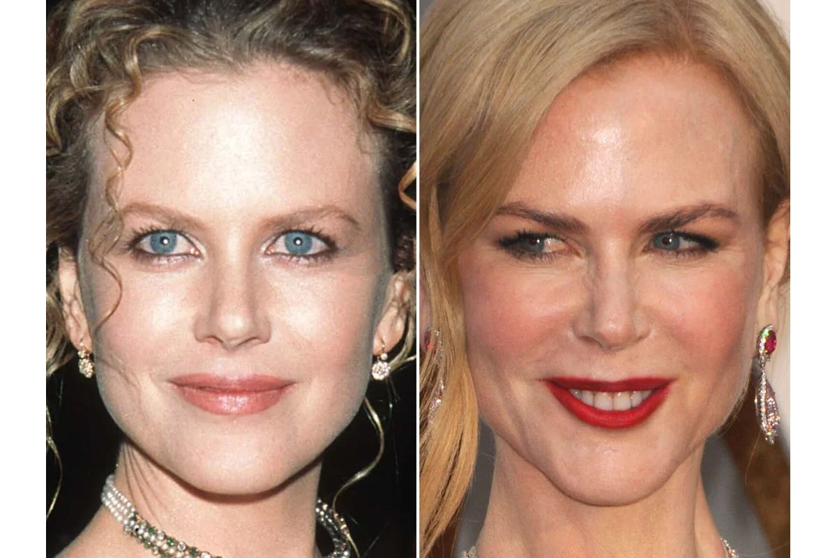 Nicole Kidman